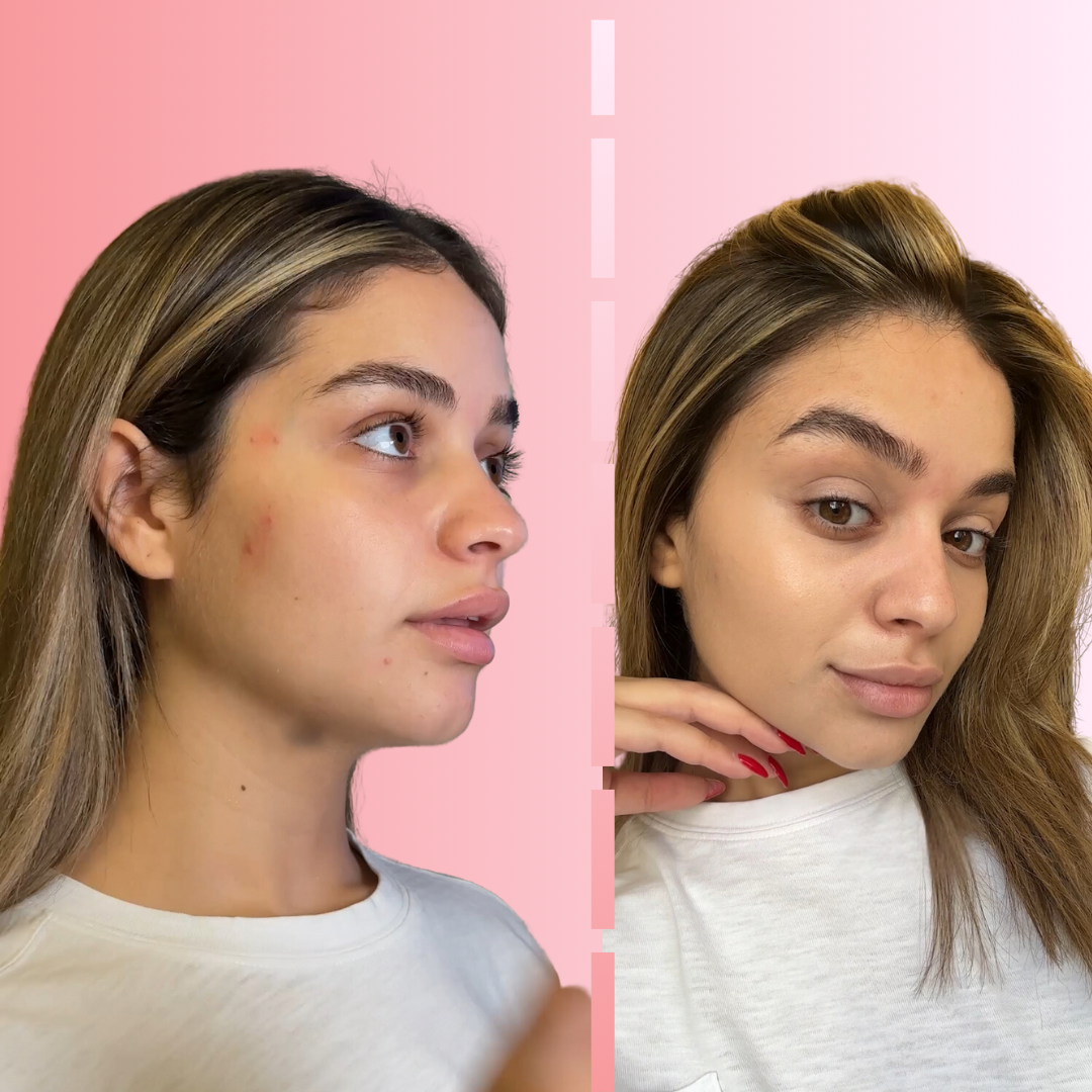 Filter My Skin - The Ultimate Cushion Foundation