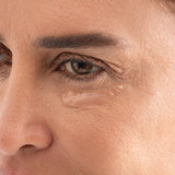 تونفيس™بوتوكس عيني
